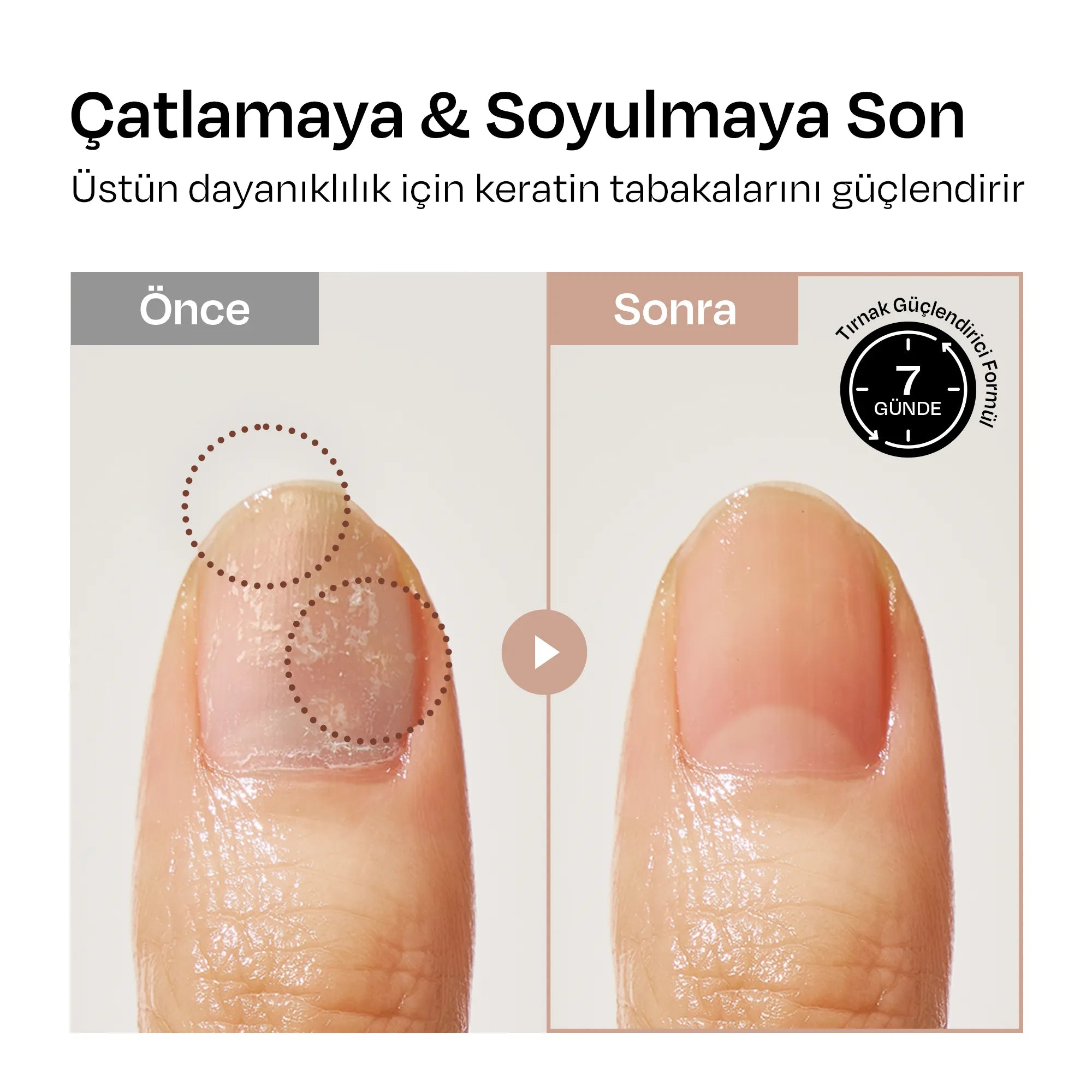 3'lü Second Skin Renkli Güçlendirici Seti