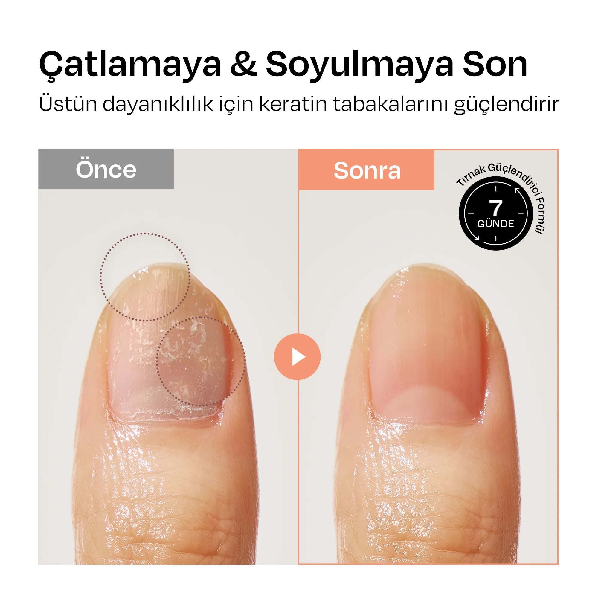 [Kayısı] Renkli Tırnak Güçlendirici