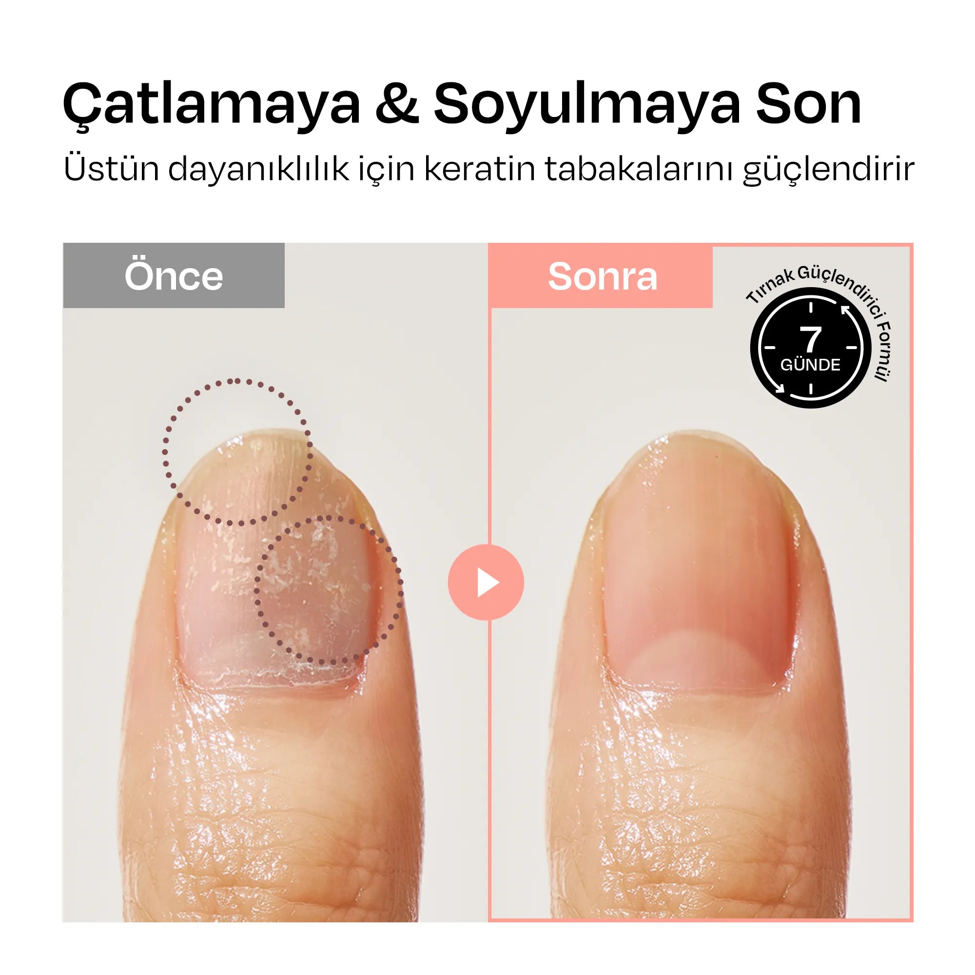 [Kuşburnu] Renkli Tırnak Güçlendirici